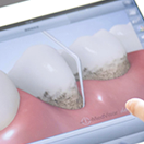 そもそも歯内療法って何？